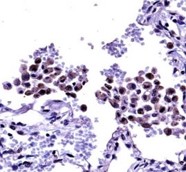Anti-TLR8 antibody immunohistochemistry analysis in formalin fixed and paraffin embedded human lung tissue