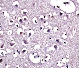 Lipoprotein Lipase Antibody Human Brain IHC. Immunohistochemical staining of formalin-fixed, paraffin-embedded human brain tissue using Lipoprotein Lipase Antibody demonstrates cytoplasmic HRP-DAB brown staining within scattered neural cell populations against a background of neuropil-rich tissue architecture. The staining pattern is consistent with expression of Lipoprotein Lipase (LPL), a key enzyme involved in triglyceride hydrolysis, fatty acid mobilization, and lipid utilization. LPL contributes to lipid processing pathways that support cellular energy balance and membrane maintenance, processes that are particularly important in metabolically active tissues. The observed staining supports the role of LPL in regulating lipid availability and fatty acid utilization within the central nervous system.