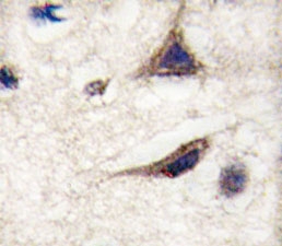 IHC analysis of FFPE human brain tissue stained with anti-TAU antibody