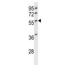 Desmin antibody western blot analysis in HL-60 lysate. Predicted molecular weight ~54kDa.