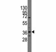 Western blot analysis of PITX2 antibody and CEM lysate. Predicted molecular weight ~35 kDa.