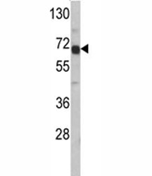 AFP Antibody HepG2 WB. Western blot analysis of AFP antibody and HepG2 lysate. Predicted molecular weight: ~70 kDa.