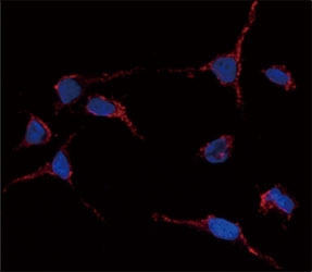 Immunofluorescence analysis of anti-ALDH1A1 antibody and HeLa cells. Primary Ab was followed by Alexa-Fluor-546-conjugated donkey anti-rabbit lgG (H+L). Alexa-Fluor-546 emits orange fluorescence. Blue counterstaining is DAPI.