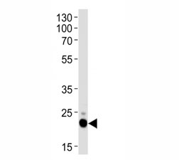 Western blot analysis of lysate from HeLa cell line using CD9 antibody.