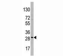 Western blot analysis of CD9 antibody and HepG2 lysate.