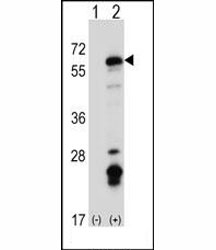 Western blot analysis of Fyn antibody and 293 cell lysate (2 ug/lane) either nontransfected (Lane 1) or transiently transfected (2) with the Fyn gene.