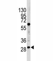 Western blot analysis of LIN28B antibody and HL-60 lysate. Predicted molecular weight ~27 kDa.