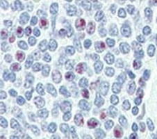 IHC analysis of FFPE human spleen tissue stained with NANOG antibody