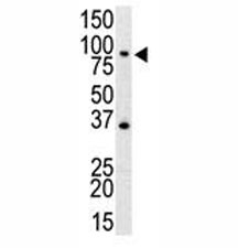 Western blot analysis of anti-TLR4 antibody and mouse spleen cell lysate.