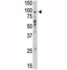 Western blot analysis of TLR6 antibody and mouse liver tissue lysate