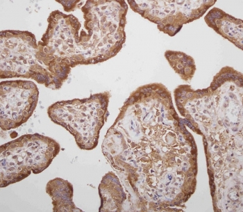 IHC staining of FFPE human placenta with Prolactin antibody. HIER: boil tissue sections in pH6, 10mM citrate buffer, for 10-20 min and allow to cool before testing.