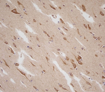 IHC staining of FFPE human brain with Prolactin antibody. HIER: boil tissue sections in pH6, 10mM citrate buffer, for 10-20 min and allow to cool before testing.