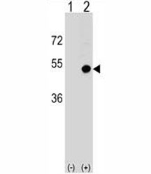 CD1d Antibody Rabbit Polyclonal used in western blot with 293 cell lysate (2 ug/lane) either non-transfected (Lane 1) or transiently transfected (2) with the CD1D gene.
