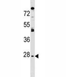 AQP1 antibody western blot analysis in mouse brain tissue lysate. Predicted molecular weight ~28kDa.