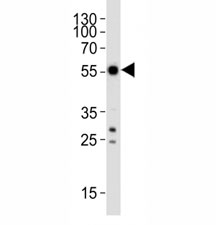 Western blot analysis of lysate from SH-SY5Y cell line using APG5/ ATG5 antibody at 1:1000. Predicted molecular weight ATG5: ~32 kDa; ATG5/ATG12 heterodimer: ~56 kDa.