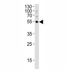 Western blot analysis of lysate from K562 cell line using ATG-5 antibody at 1:1000. Predicted molecular weight ATG5: ~32 kDa; ATG5/ATG12 heterodimer: ~56 kDa.