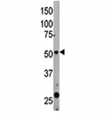 The Beclin 1 antibody used in western blot to detect BECN1 in mouse liver tissue lysate