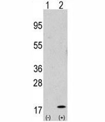 Western blot analysis of GABARAP antibody and 293 cell lysate either nontransfected (Lane 1) or transiently transfected with the GABARAP gene (2).