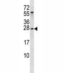 RAB5B antibody western blot analysis in mouse liver tissue lysate