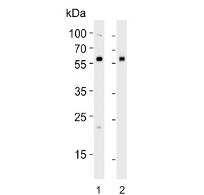Western blot testing of 1) human HEK293 and 2) mouse NIH-3T3 cell lysate with ALK3 antibody. Predicted molecular weight ~60 kDa. 