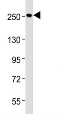 Western blot testing of Nestin antibody at 1:2000 dilution + HeLa lysate;  Predicted molecular weight ~177 kDa but can be observed at up to 280 kDa.