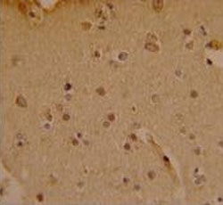IHC analysis of FFPE human brain stained with SOX4 antibody