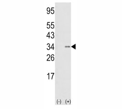Western blot analysis of anti-SNAIL antibody and 293 cell lysate (2 ug/lane) either nontransfected (Lane 1) or transiently transfected with the SNAIL gene (2). Predicted molecular weigth ~29kDa.