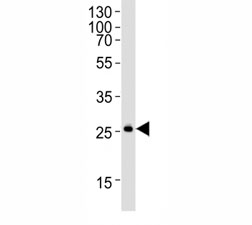 Western blot analysis of mouse kidney lysate using SNAI1 antibody at 1:1000.