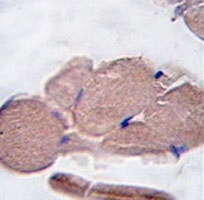 Myostatin Antibody Skeletal Muscle IHC. Immunohistochemistry analysis of FFPE human skeletal muscle tissue stained with Myostatin Antibody / Muscle Growth Regulator Antibody demonstrates diffuse cytoplasmic HRP-DAB brown staining throughout skeletal myofibers. The staining pattern is consistent with expression of Myostatin (MSTN), also known as Growth Differentiation Factor 8 (GDF8), a member of the TGF-beta superfamily that functions as a key negative regulator of skeletal muscle growth and differentiation. Widespread immunoreactivity within muscle fibers supports the established role of Myostatin in regulating muscle mass, myofiber homeostasis, tissue remodeling, and myogenic signaling pathways. The observed staining demonstrates the utility of this antibody for studies of skeletal muscle biology, muscle growth regulation, regenerative processes, and muscle-related disease mechanisms.