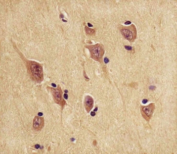 IHC analysis of FFPE human brain tissue stained with the PGP9.5 antibody