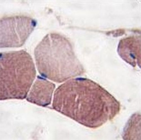 IHC analysis of FFPE human skeletal muscle tissue stained with UCHL3 antibody