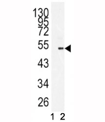 Western blot analysis of BMI1 antibody and 293 lysate in the presence (1) and absence (2) of immunizing peptide.