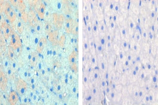 IHC data of FFPE cow lactation tissue tested with CPT1A antibody (left) and without primary Ab (right). This data was kindly offered by Hideaki Hayashi, University of Bern, Switzerland.