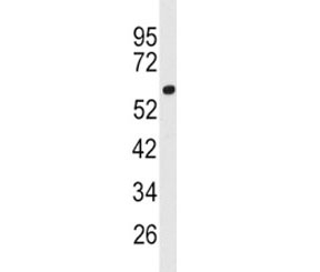 Western blot analysis of ACSL3 antibody and human 293 lysate. Predicted molecular weight ~80 kDa.