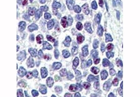 IHC analysis of FFPE human spleen tissue stained with KLF4 antibody
