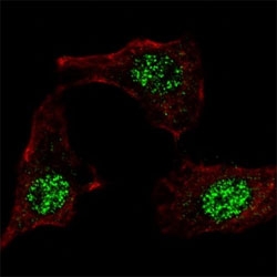 IF staining of HeLa cells with KLF4 antibody at 1:100, response is localized to the nuclei.