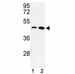 Western blot analysis of KLF4 antibody and MDA-MB231, NCI-H460 lysate. Predicted molecular weight: 50-60 kDa + possible ~75 kDa (phosphorylated form).