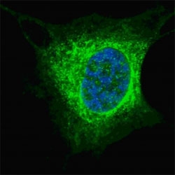 Vimentin Antibody for IF / Cytoskeletal Filament Marker Antibody. Immunofluorescence analysis of Vimentin / VIM in human SY5Y cells demonstrating strong cytoplasmic filamentous staining (green) consistent with intermediate filament network organization. The Vimentin Antibody for IF / Cytoskeletal Filament Marker Antibody highlights an extensive cytoskeletal filament pattern extending from the perinuclear region toward the cell periphery, characteristic of Vimentin filament architecture. Nuclei are counterstained with DAPI (blue), and the staining pattern supports high-resolution visualization of cytoskeletal structure in confocal imaging applications.