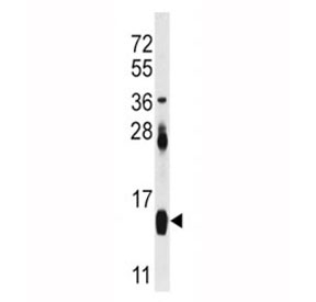 FABP4 Antibody Mouse Heart WB. Western blot analysis of FABP4 antibody and mouse heart tissue lysate. Predicted molecular weight ~15 kDa.