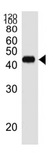 Western blot analysis of lysate from RPMI8226 cell line using CD38 antibody diluted at 1:1000.
