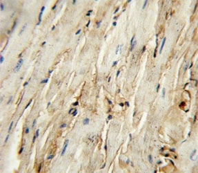 CD105 Antibody Mouse Heart IHC. CD105 antibody immunohistochemistry analysis in formalin fixed and paraffin embedded mouse heart tissue.