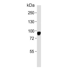 Western blot analysis of CD105 antibody and human HeLa cell lysate. Observed molecular weight: 70/90 kDa (monomer, unmodified/glycosylated); 140-180 kDa (dimer, unmodified/glycosylated).