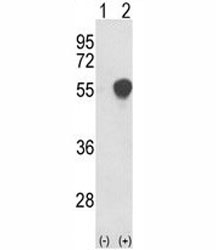 Phosphoglycerate Dehydrogenase Antibody Transfected Cell WB. Western blot testing of human 293 cell lysates with Phosphoglycerate Dehydrogenase Antibody. Lane 1: non-transfected 293 cells; Lane 2: 293 cells transiently transfected with the PHGDH gene. Predicted molecular weight: ~56 kDa. Phosphoglycerate Dehydrogenase Antibody / PGDH Antibody detects PHGDH expression following gene transfection and supports studies of serine biosynthesis, amino acid metabolism and metabolic enzyme regulation pathways.