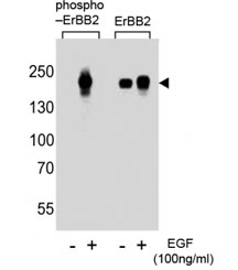 Phospho-ErbB2 (pY1112) Antibody EGF-Stimulated WB. Western blot analysis of human A431 cell lysates treated with or without EGF (100 ng/ml) using Phospho-ErbB2 (pY1112) Antibody detects a band at approximately 185 kDa in EGF-stimulated samples, consistent with the predicted molecular weight of phosphorylated ErbB2 / HER2, while untreated samples show reduced signal; parallel detection with a nonphospho ErbB2 antibody confirms total receptor expression across conditions, supporting phosphorylation-dependent adaptor recruitment at Tyr1112.