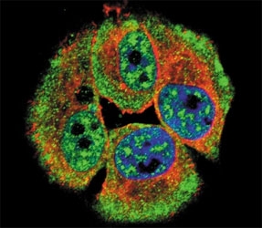 Phospho-ERBB4 (pY1162) Antibody MCF-7 IF. Immunofluorescence analysis of human MCF-7 cells stained with Phospho-ERBB4 (pY1162) Antibody (green) demonstrates cytoplasmic and peripheral membranous signal consistent with activated HER4 / ERBB4 localization, while actin filaments are labeled with phalloidin (red) and nuclei are counterstained with DAPI (blue).