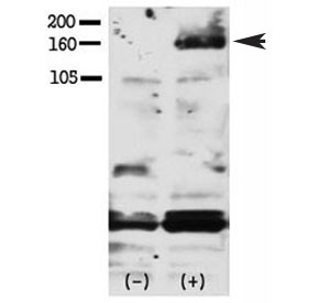Phospho-HER4 (pY1188) Antibody EGF-Stimulated WB. Western blot analysis of human FG pancreatic carcinoma cell lysates treated with or without EGF (50 ng/ml, 15 min) using Phospho-HER4 (pY1188) Antibody detects a band at approximately 160â180 kDa in stimulated samples, consistent with the predicted molecular weight of phosphorylated HER4 / ERBB4, while untreated samples show reduced signal, supporting phosphorylation-dependent regulatory signaling at Tyr1188.