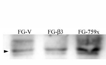 Western blot analysis of Phospho-Src (pY215) antibody in human FG pancreatic carcinoma cell lines. Lysates from human FG pancreatic carcinoma cells stably expressing vector control (lane 1, FG-V), beta 3 integrin subunit (lane 2, FG-b3), or beta 3 truncation mutant (lane 3, FG-759x) were probed with Phospho-Src antibody. A band is detected near the predicted molecular weight of Src, consistent with phosphorylated Src protein. Increased band intensity is observed in cells expressing beta 3 integrin and the truncation mutant compared to vector control, indicating relative differences in Src phosphorylation levels among the cell lines.