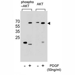 Phospho-AKT (pS473) Antibody PDGF Treated NIH3T3 WB. Western blot analysis of extracts from NIH3T3 cells, untreated or treated with PDGF, using phospho-AKT antibody (left) or nonphos-AKT antibody (right).