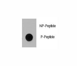 Phospho-Dnmt1 Antibody (pS714) Dot blot. Dot blot analysis of phospho-Dnmt1 antibody. 50ng of phos-peptide or nonphos-peptide per dot were spotted.