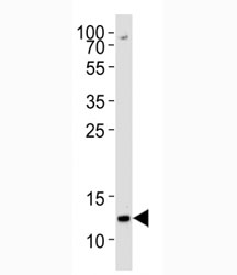 H4 Antibody Methyl-Lys20 Specific WB. Western blot analysis of histone H4 lysine 20 methylation in human K562 cell lysate using H4 Antibody Methyl-Lys20 Specific. Lane 1: K562 whole cell lysate. A band is detected at approximately 11 kDa, consistent with the predicted molecular weight of Histone H4 (HIST1H4). The signal reflects endogenous methylation at lysine 20, a chromatin-associated modification linked to genome stability and chromatin compaction.